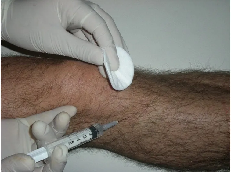 Traumi articolari e dolori cervicali possono essere curati con la mesoterapia omeopatica