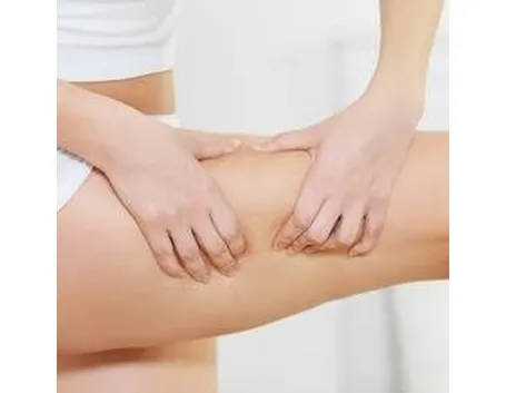 cellulite