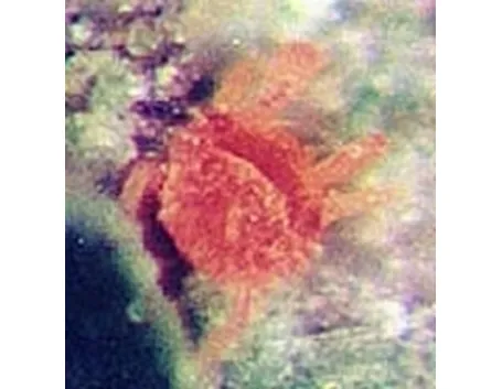 acaro