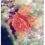 acaro