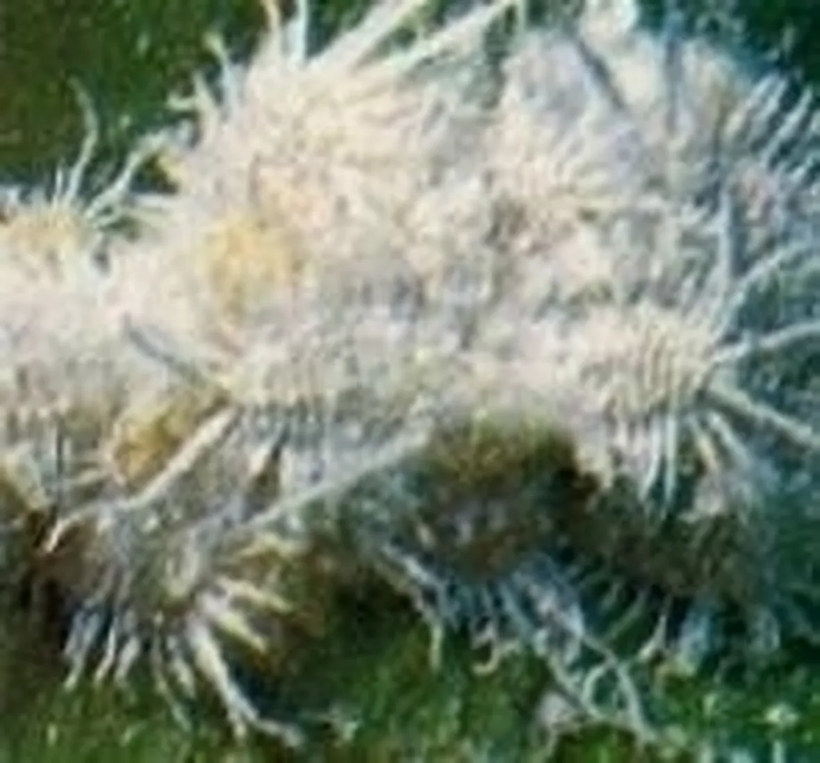 http://static.giardinaggio.it/parassiti/cocciniglia_N1.jpg