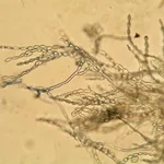 Fungo microscopio
